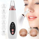 Pore and blackhead remover